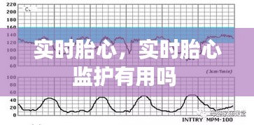 实时胎心，实时胎心监护有用吗 