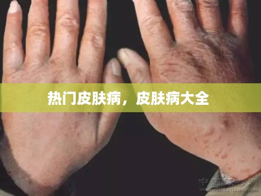热门皮肤病，皮肤病大全 