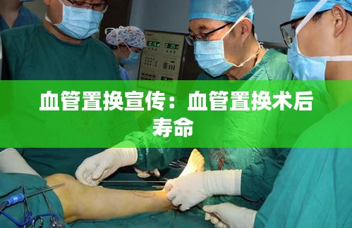 血管置换宣传：血管置换术后寿命 