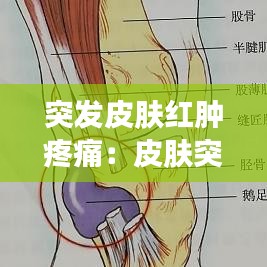 突发皮肤红肿疼痛：皮肤突然剧痛发红 