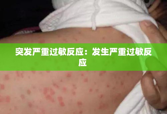 突发严重过敏反应：发生严重过敏反应 