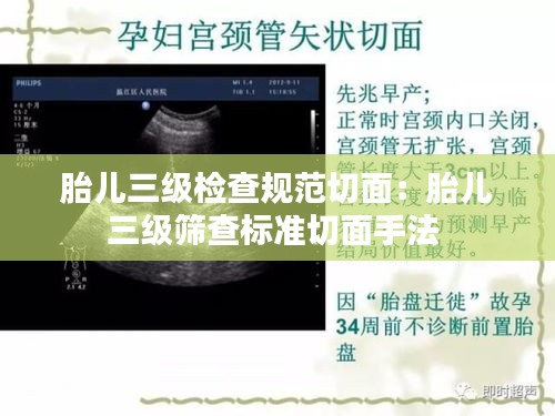 胎儿三级检查规范切面：胎儿三级筛查标准切面手法 