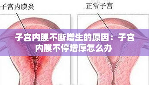 子宫内膜不断增生的原因：子宫内膜不停增厚怎么办 