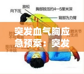 突发血气胸应急预案：突发气胸急救措施 