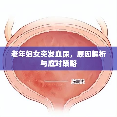 老年妇女突发血尿，原因解析与应对策略