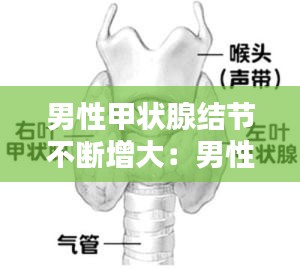 男性甲状腺结节不断增大：男性甲状腺有结节 