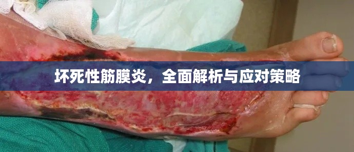 坏死性筋膜炎，全面解析与应对策略