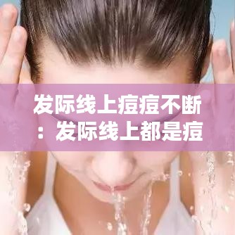 发际线上痘痘不断：发际线上都是痘痘 