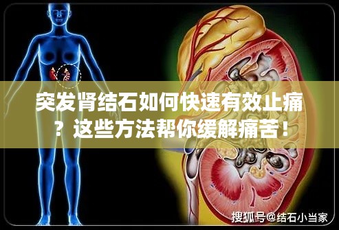 突发肾结石如何快速有效止痛？这些方法帮你缓解痛苦！