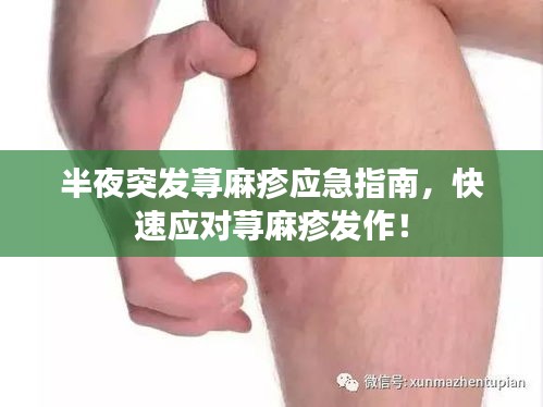 半夜突发荨麻疹应急指南，快速应对荨麻疹发作！