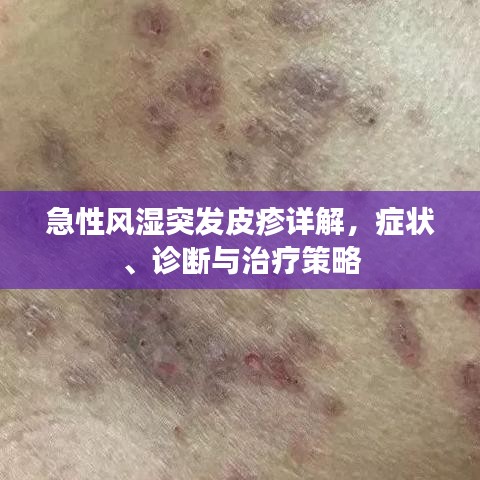 急性风湿突发皮疹详解，症状、诊断与治疗策略