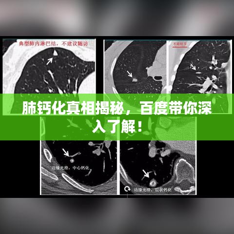 肺钙化真相揭秘，百度带你深入了解！