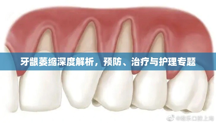 雅量高致