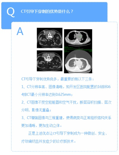 健康余杭官方下载,权威方法解析 CT_v10.805